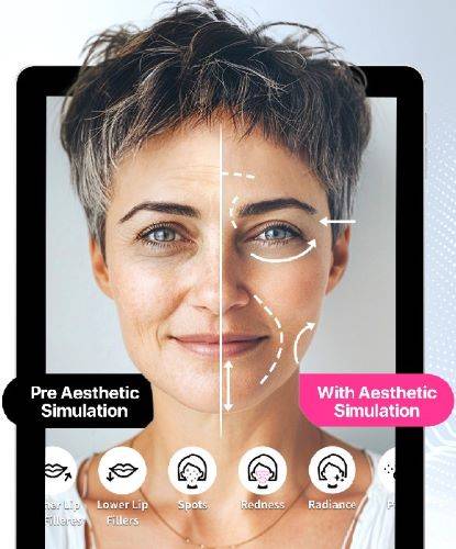 Skincare Pro Aesthetic Simulator, Solusi Berteknologi AI untuk Simulasi Prosedur Estetika Non-Bedah